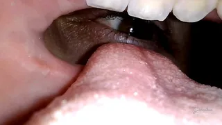 Reverse mouth view licking