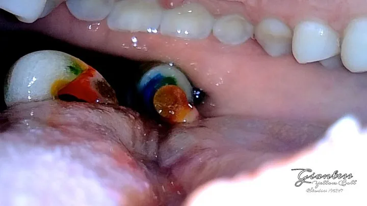 Lollipop inside mouth view