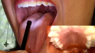 Mouth tour double cam