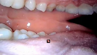 ASMR routine inside my mouth