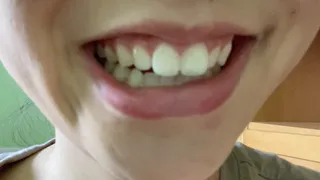 Aurora's Teeth Tease You Madly Again