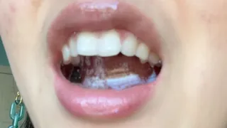 Aurora's Teeth and Spilling Saliva