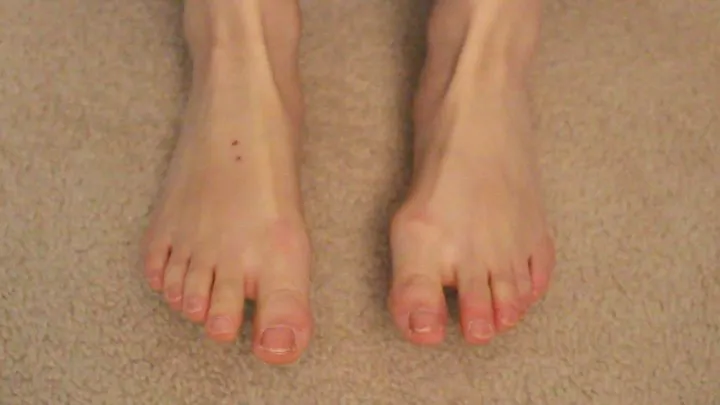 Aurora's Bountiful Bunions