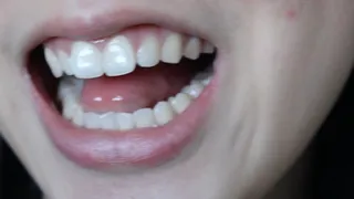 Aurora Has Pretty Teeth