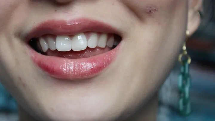 Aurora's Teeth Shine Bright Like A Diamond