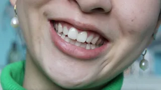 Aurora's Pearly White Teeth