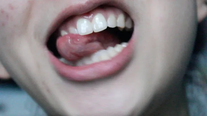 Aurora's Teeth Want You