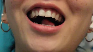 Aurora's Shiny Teeth