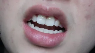 Aurora Flashes Her Gorgeous Teeth