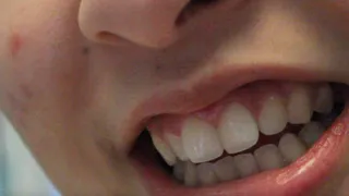 Aurora's Sexy Teeth Take Charge
