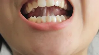 Aurora's Teeth Are A Treasure