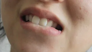 Aurora's Teeth Bite To Your Delight