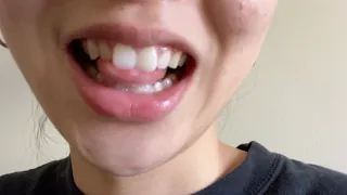 Aurora Teases With Her Teeth