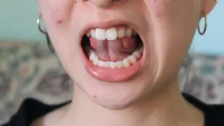 Aurora's Teeth Teases