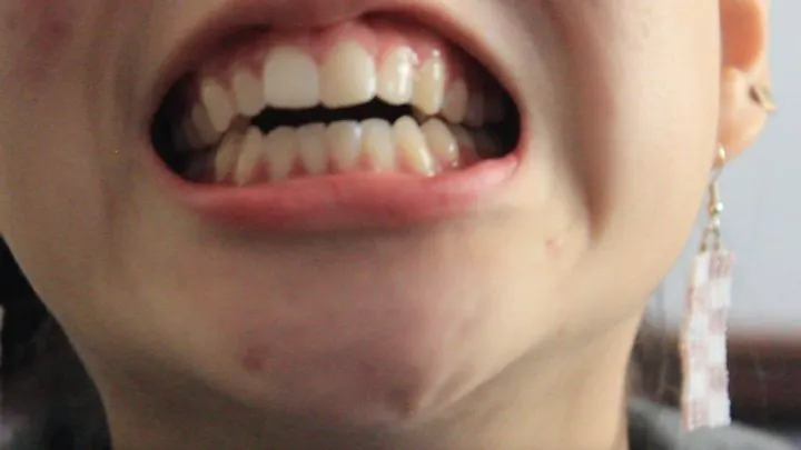 Aurora's Gorgeous Teeth Part 2