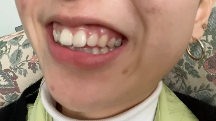 Aurora's Wonderful White Teeth