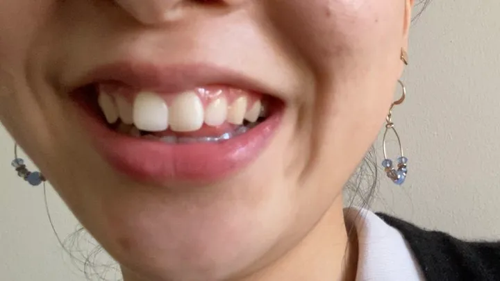 Aurora's Teeth Are So Hard To Resist Part 1