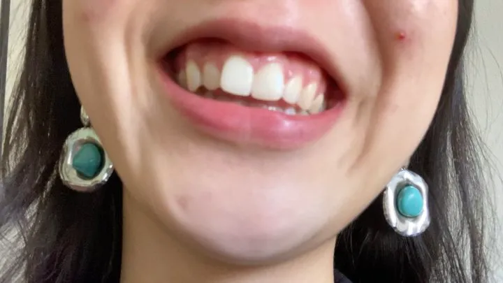 Let Aurora's Teeth Tempt You Madly Part 4