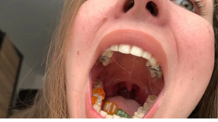 Gummy bears vs my powerful teeth full