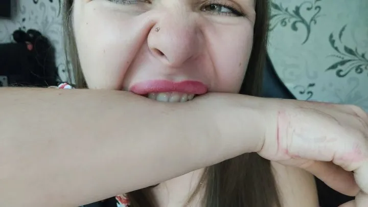 Angelica's hard bites!!