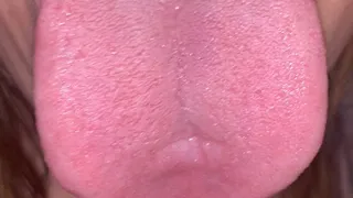 Take a look inside my mouth