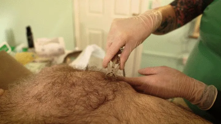 GU Clinic : Needles