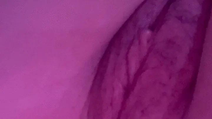 Bruised vagina