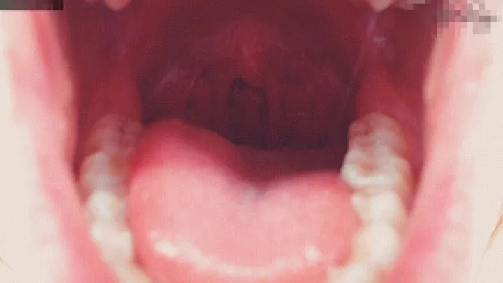 Smell my dirty uvula and mouth