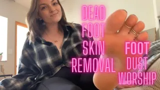 From dry crusty feet to soft perfect soles- buy my foot dust