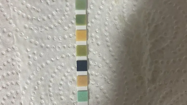 Nurse Gets A Urinalysis