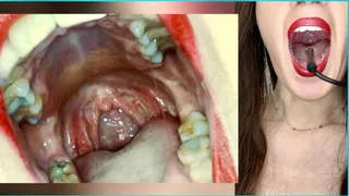 Endoscopic journey through my mouth