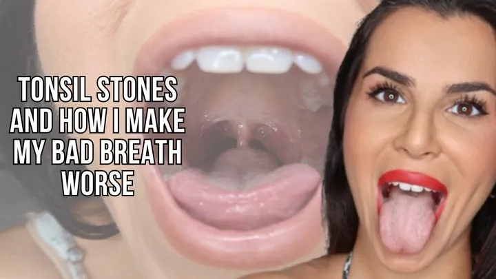 Tonsil stones and how I make my bad breath worst - Lalo Cortez and Vanessa (custom clip)