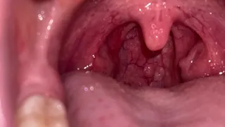 MOUTH TOUR FLASH ON DEEP INSIDE MY MOUTH