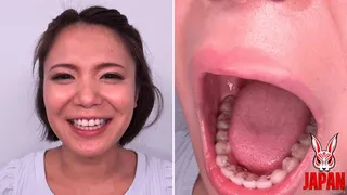 Teeth Examination: Beauty Unveiled