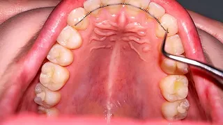 Teeth Examination