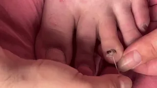 poking a fake fingernail with pins