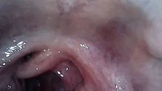 stomach endoscope