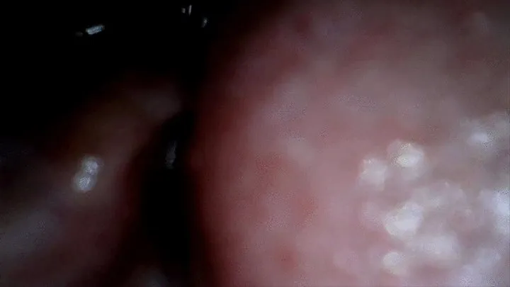 swallowing toy attached to endoscope