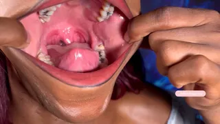 MelaninTongue gives you Another tour of her big wide amazing mouth