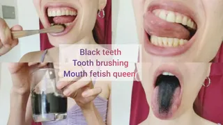 Black teeth