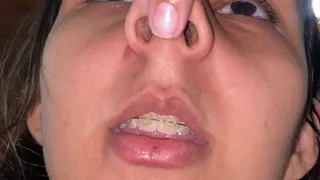 Pignose Close-Up