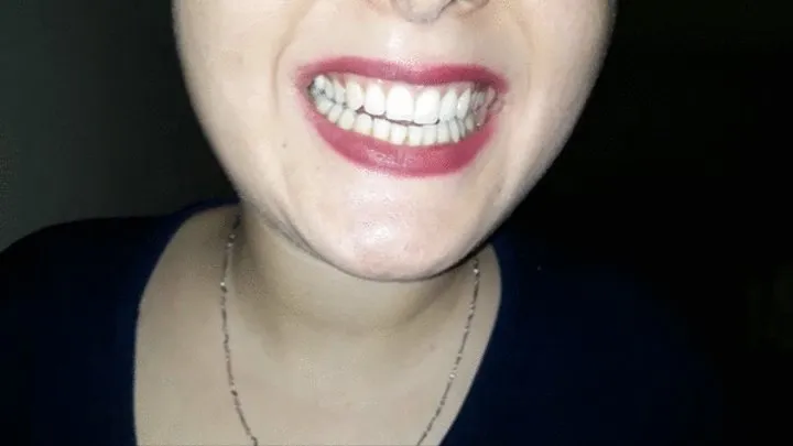 Missprettymouth teeth