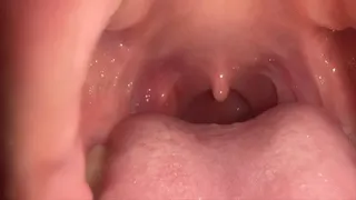 Moving my uvula