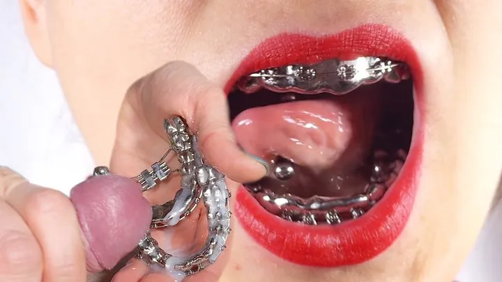 ALL-METAL Braces CUMMED, HOT handjob & cock-biting