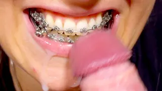 Braces HERBST German dirty-talk, HUGE cumshot