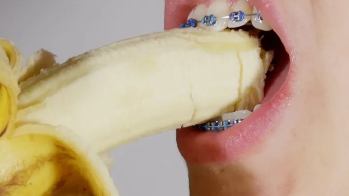 braces close-up and eating banana