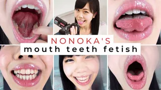 Dental Selfies with Naughty Nonoka OZAKI
