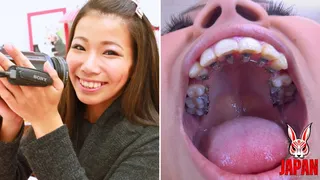 Orthodontic Teeth Fetish : Izumi Asato's Dental Fantasy