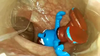 Huge Endoscope in Little Doll in Asian ass