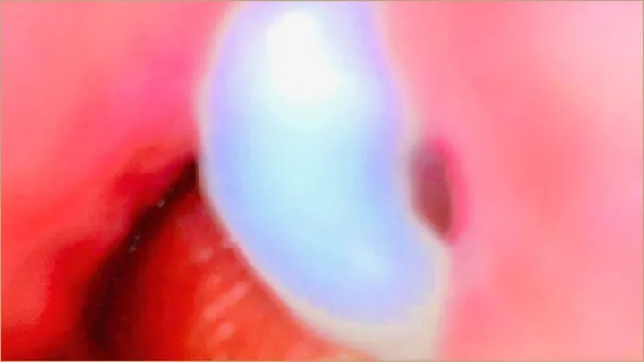 Endoscope Camera Inside My Pink Pussy Records How He Fills Me With Cum - Couple Keyla & Lucas